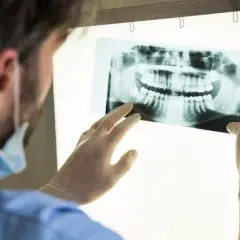 Co obejmuje dentysta NFZ? Sprawdź usługi i limity refundacji