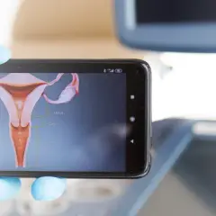 Gdzie sprawdzić wynik cytologii NFZ i uniknąć niepotrzebnych opóźnień