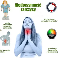 Ilustracja przedstawia objawy niedoczynności tarczycy: przyrost masy ciała, zmęczenie, bóle mięśni, wahania nastroju, suchą skórę, wypadanie włosów, problemy z pamięcią i koncentracją, nieregularne miesiączki.