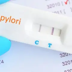 NFZ nie refunduje badania helicobacter pylori z krwi – co wybrać?