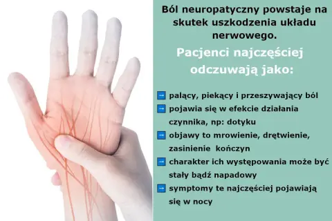 Dłoń z zaznaczonymi nerwami, ilustrująca ból neuropatyczny. Opisuje palący, piekący ból, mrowienie i drętwienie.