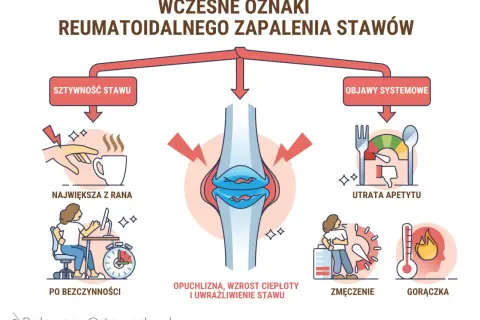 Wczesne oznaki rzs: sztywność stawu (największa z rana, po bezczynności), opuchlizna, utrata apetytu, zmęczenie, gorączka.