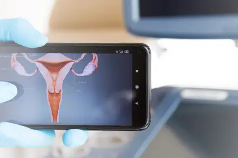 Gdzie sprawdzić wynik cytologii NFZ i uniknąć niepotrzebnych opóźnień