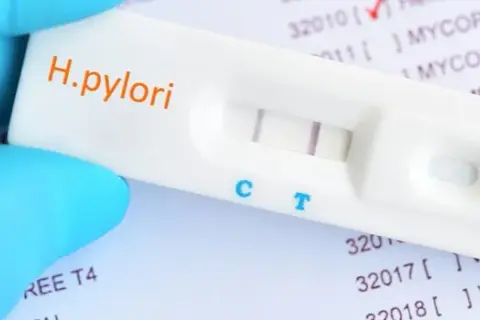 NFZ nie refunduje badania helicobacter pylori z krwi – co wybrać?