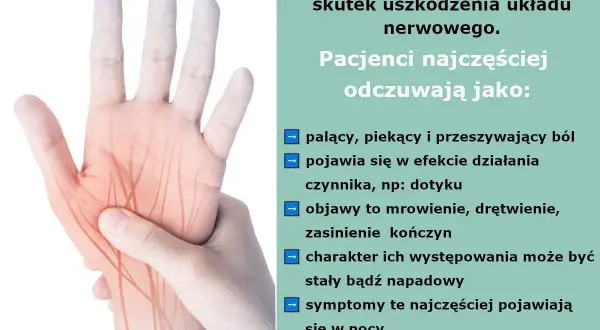 Dłoń z zaznaczonymi nerwami, ilustrująca ból neuropatyczny. Opisuje palący, piekący ból, mrowienie i drętwienie.