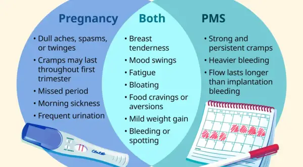 Wykres porównuje objawy ciąży i PMS. Plamienie implantacyjne może być mylone z PMS, ale jest zazwyczaj łagodniejsze.