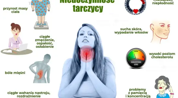 Ilustracja przedstawia objawy niedoczynności tarczycy: przyrost masy ciała, zmęczenie, bóle mięśni, wahania nastroju, suchą skórę, wypadanie włosów, problemy z pamięcią i koncentracją, nieregularne miesiączki.
