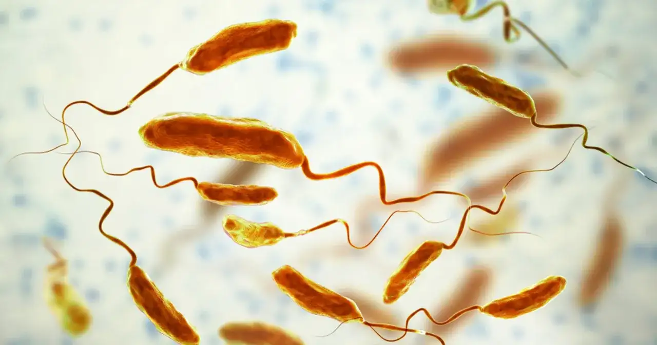 Cholera - objawy, leczenie, zapobieganie. Kiedy to stan nagły?