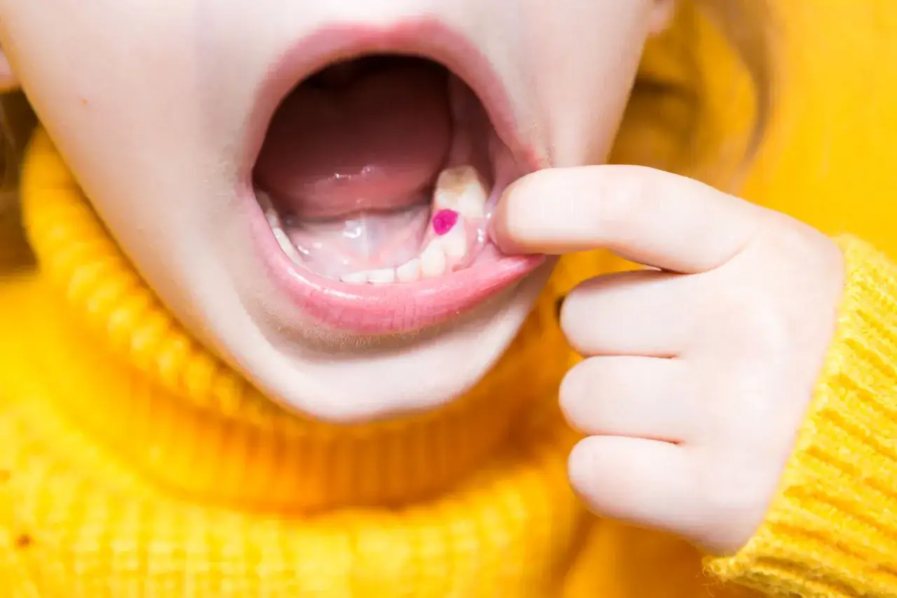 Zdjęcie Czy znieczulenie u dentysty jest na nfz? Sprawdź, co musisz wiedzieć