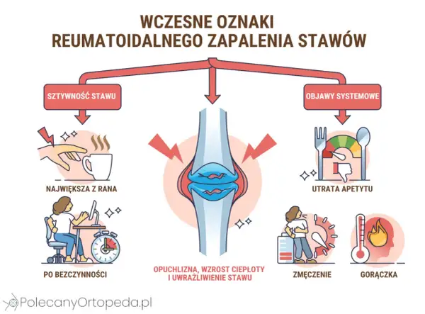 Wczesne oznaki rzs: sztywność stawu (największa z rana, po bezczynności), opuchlizna, utrata apetytu, zmęczenie, gorączka.