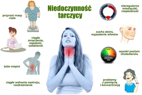 Ilustracja przedstawia objawy niedoczynności tarczycy: przyrost masy ciała, zmęczenie, bóle mięśni, wahania nastroju, suchą skórę, wypadanie włosów, problemy z pamięcią i koncentracją, nieregularne miesiączki.